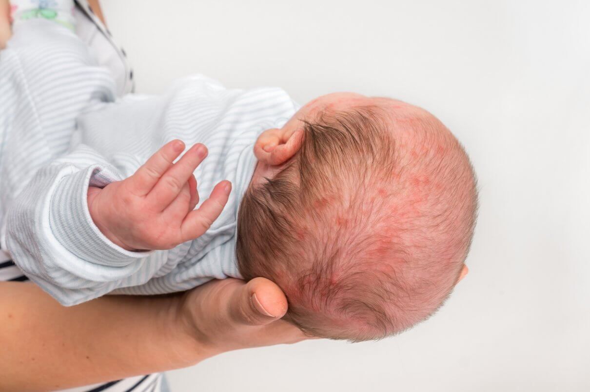 How Do I Know If My Child’s Birth Injury Is a Birth Defect or the Result of Negligence?