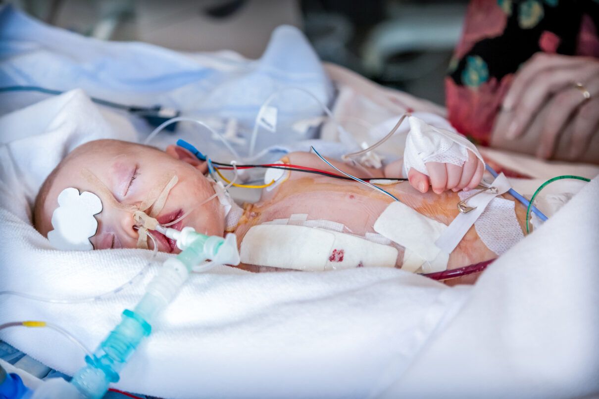 a baby after a birth injury.