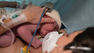 baby suffering from NEC